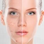 10 Best Serum for Dark Spots and Pigmentation